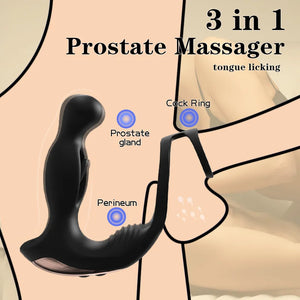Fizzglow Surge 3-in-1 Prostate Massager and Anal Vibrator with Penis Ring