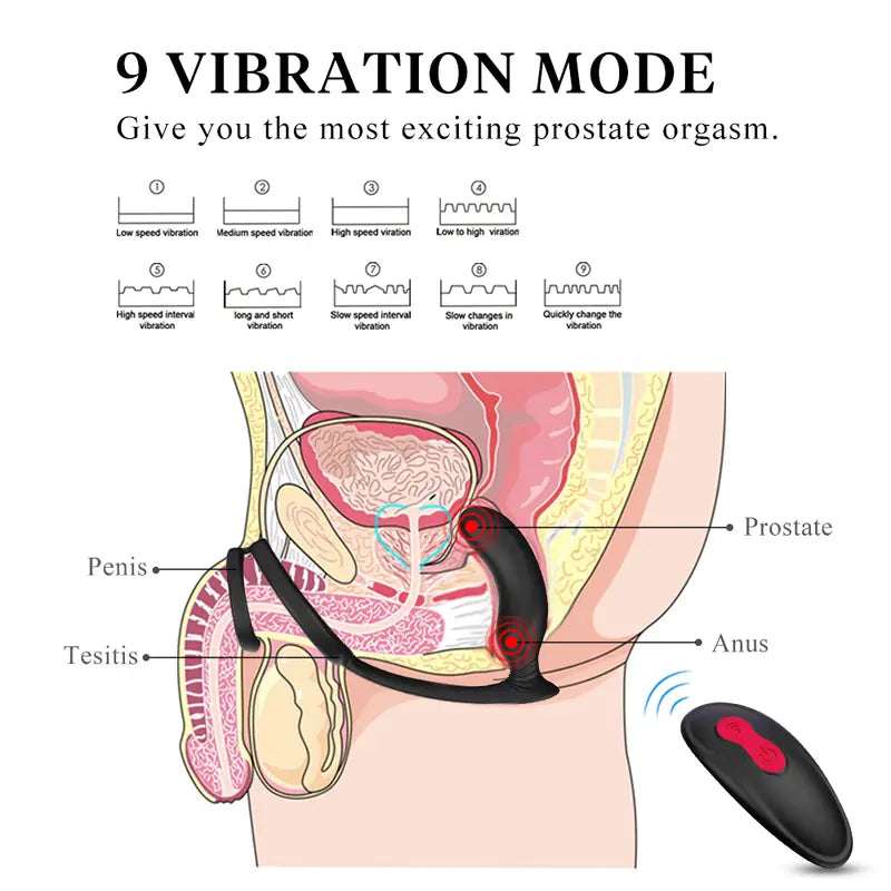 Anatomical diagram of Fizzglow Crest prostate anal vibrator showing 9 vibration modes and P-spot stimulation.